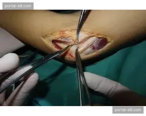 加拿大女垒主力投手伤愈复出专访:“肘部手术后的300天,我比以往更强大”